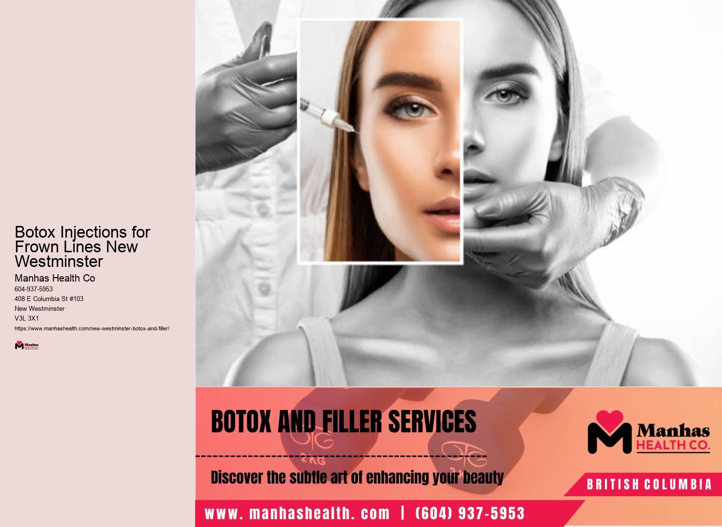 Botox Injections for Lip Lines New Westminster