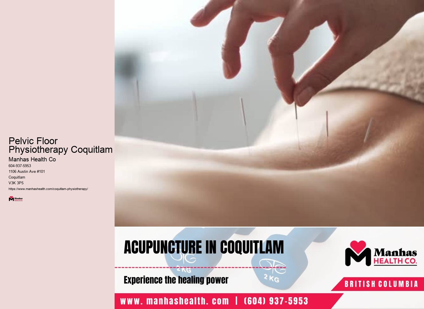 Convenient Physiotherapy Appointments Coquitlam